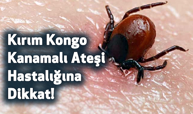 Kırım Kongo Kanamalı Ateşi Hastalığına Dikkat!