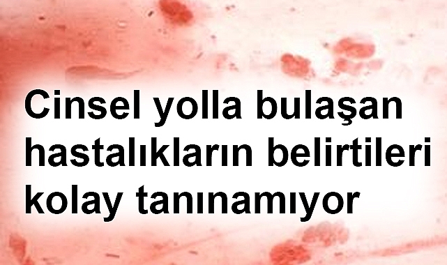 Cinsel Yolla Bulaşan Hastalıklara Dikkat!