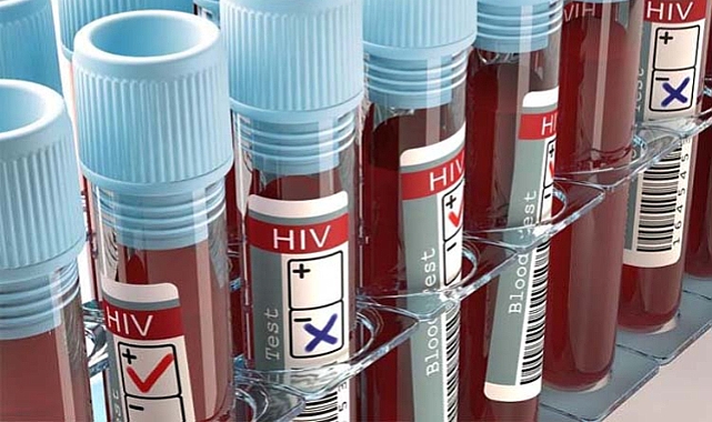 HIV Testi: Bilgi, Farkındalık, Güvenlik