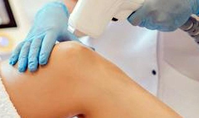 Lazer Epilasyon Zararlı Mı?