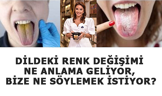Dildeki Renk Değişimi Bize Ne Anlatıyor?
