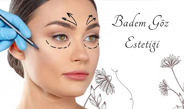 Badem Göz Estetiği Hakkında Bilinmesi Gerekenler