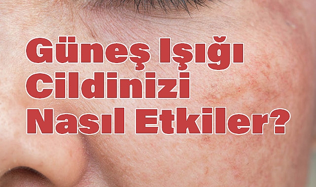 Güneş Işığı Cildinizi Nasıl Etkiler?