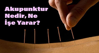 Akupunktur Nedir, Ne İşe Yarar?