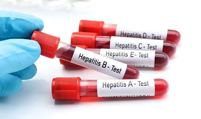 Tedavi Edilmeyen Hepatit Ölümcül Olabiliyor!