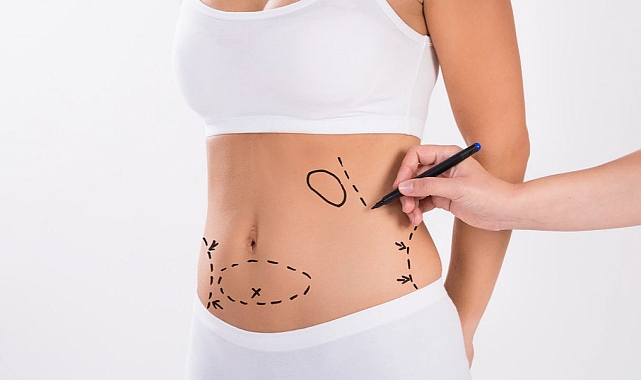 Kalıcı Yağlara Liposuction ile Elveda