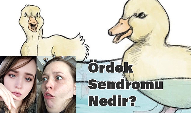 Ördek Sendromu Nedir? Görünenin Ardındaki Gerçekler