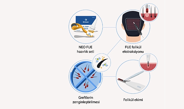 ElitHair Kliniğinde DHI Saç Ekim Operasyonu