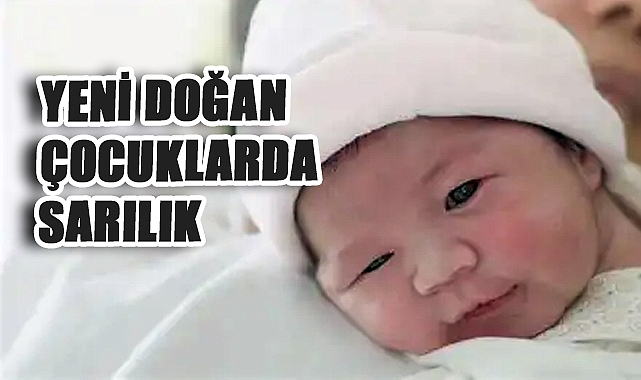 Yenidoğan Bebeklerde Sarılık