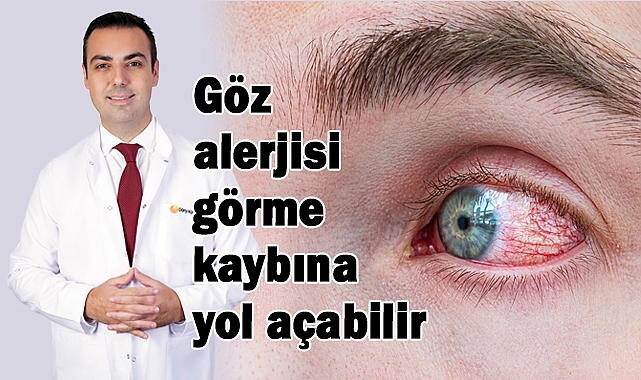 Göz alerjisi görme kaybına yol açabilir