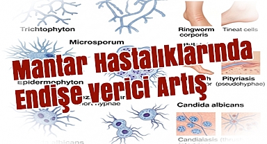 Mantar Hastalıklarında Endişe Verici Artış