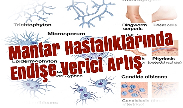 Mantar Hastalıklarında Endişe Verici Artış