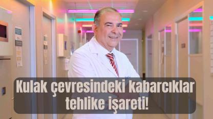 Yüz Felci Hafife Alınmamalı