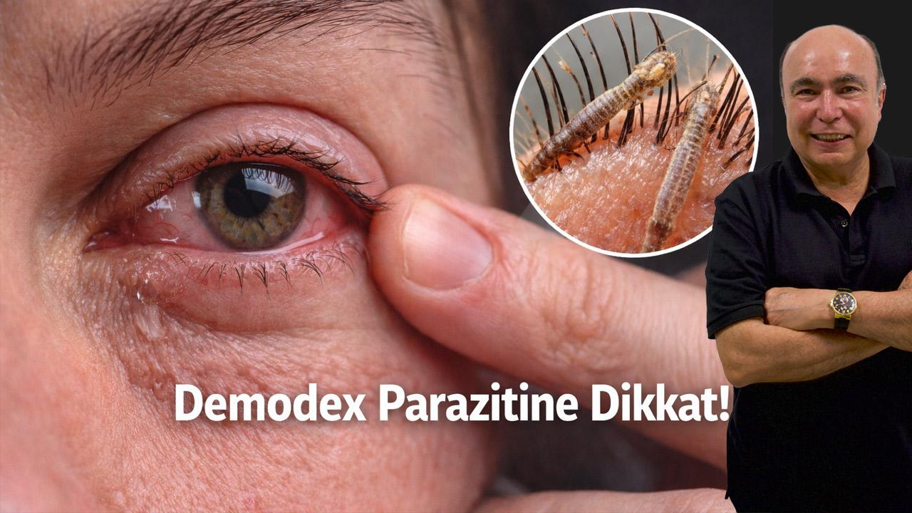 Gözde Yanma, Sulanma ve Kaşıntının Nedeni Bu Parazit Olabilir